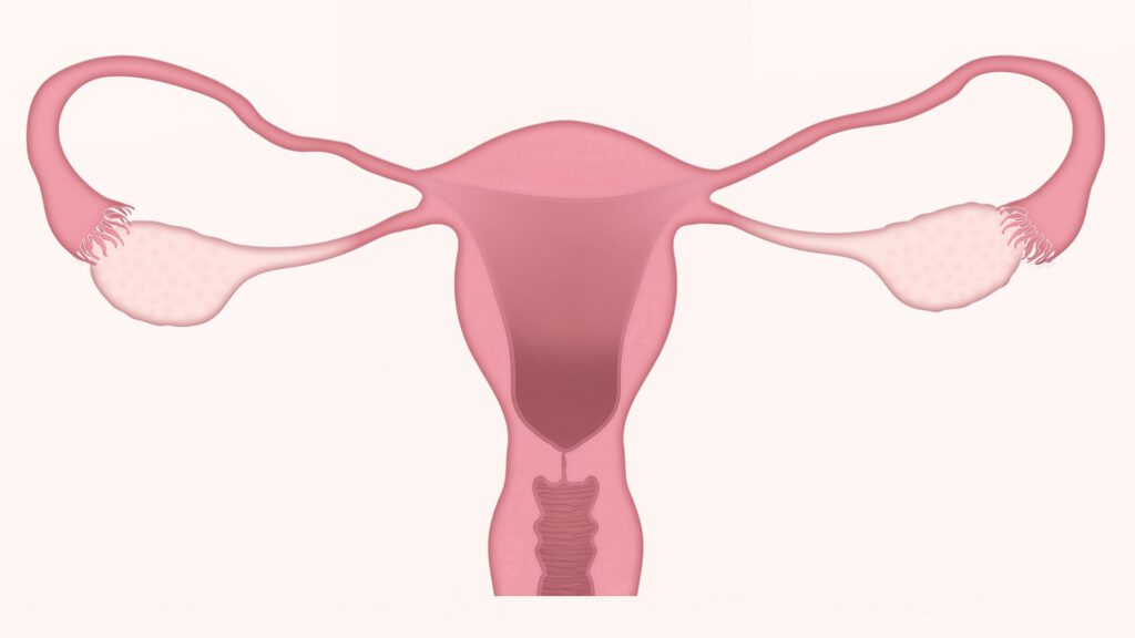 Schematische Darstellung Uterus